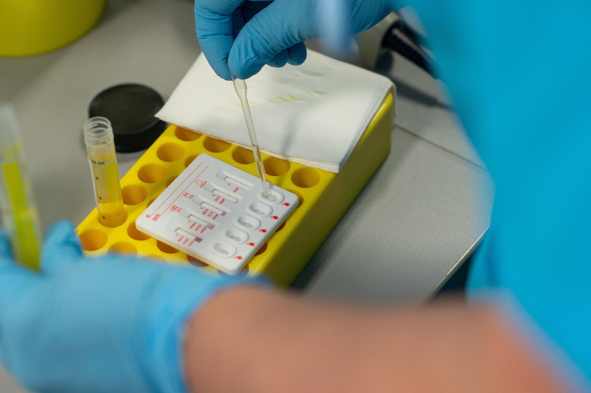 Eine Mitarbeiterin eines Labors untersucht eine Urinprobe.